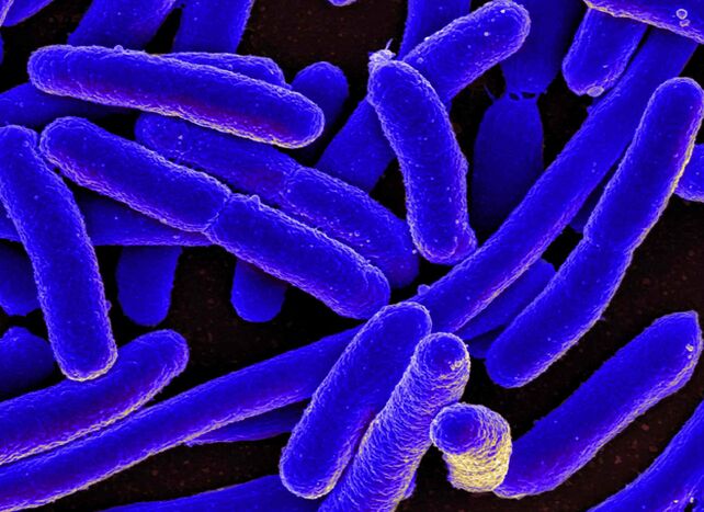 E. coli déclenche le plus souvent le développement de la cystite chez la femme